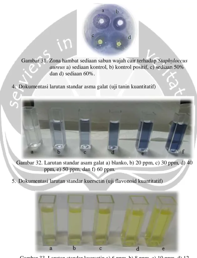 Gambar 31. Zona hambat sediaan sabun wajah cair terhadap Staphyloccus        aureus a) sediaan kontrol, b) kontrol positif, c) sediaan 50% 