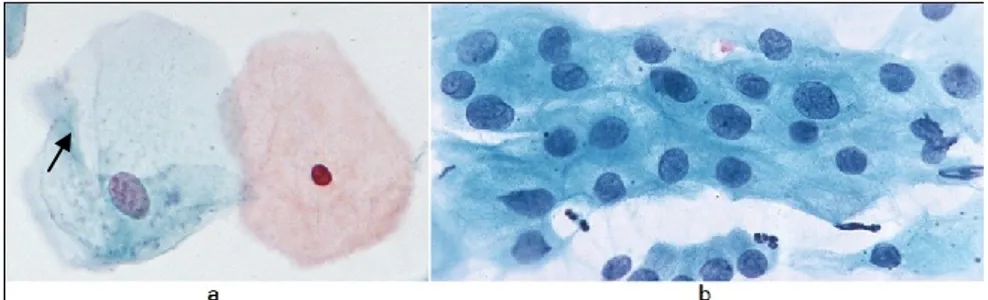 Gambar 1.  (a) Citra Pap smear dengan batas  sitoplasma tiap nuclei yang jelas, (b) Citra Pap smear dengan batas sitoplasma tiap  nuclei yang tidak jelas