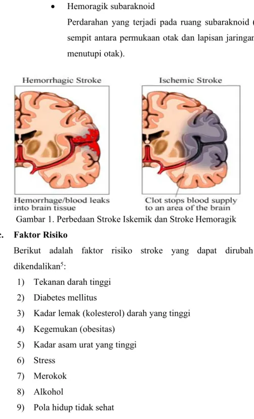 Gambar 1. Perbedaan Stroke Iskemik dan Stroke Hemoragik  c.  Faktor Risiko 