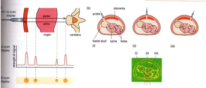 Gambar 10.22 Pulsa yang tampak pada layar merepresentasikan gelombang yang dipantulkan  pada batas antara organ-organ dalam tubuh