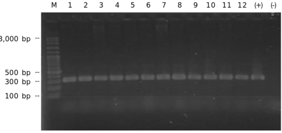 Gambar 3. Amplifikasi gen -aktin ikan mas sebagai kontrol internal dengan PCR (1-12 = sampel, (+) = kontrol positif, (-) = kontrol negatif)