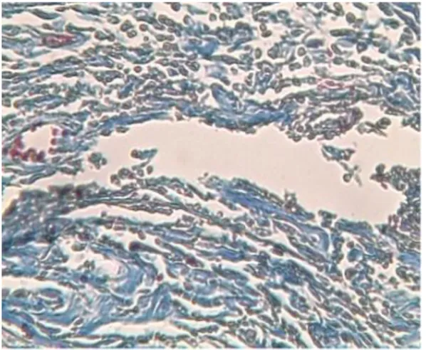 Gambar 2.  Cara pengukuran  ketebalan lapisan epitel (μm) gingiva. Pengukuran dila- dila-kukan dari lapisan basal hingga keratin secara tegak lurus