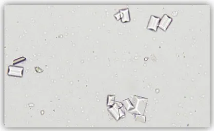 Gambar 3. Kristal Struvite. Dikutip dari Rizzi, 2014  Kalsium Oksalat 
