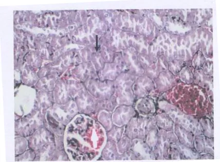 Gambar 1. Gambaran histopatologis ginjal tikus wistar pada kelompok K (400x) 