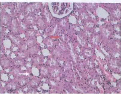 Gambar 4. Gambaran histopatologis hepar tikus wistar pada kelompok P3(400x)  Keterangan :     Sel tubulus ginjal normal 