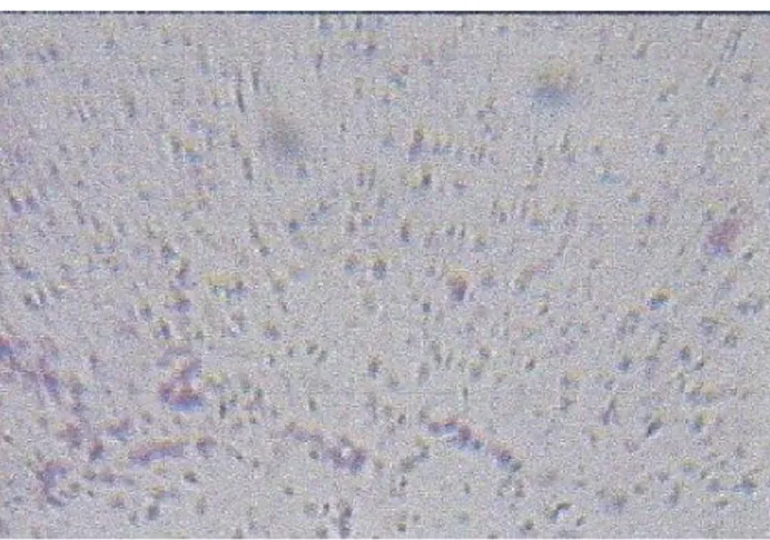 Gambar  sampel  spermatozoa  yang  didapat  dari  hasil  pengamatan  mikroskop  digital  dengan  kamera  mikroskop  yang  dirancang  oleh  penulis  menggunakan  perbesaran  mikroskop  sebesar  600X,  hasil  yang  didapat  masih  kurang  bagus