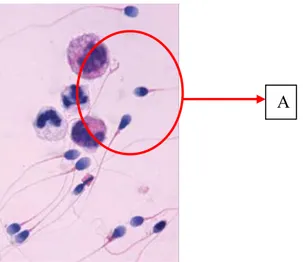 Gambar 4.13 Gambar citra spermatozoa 