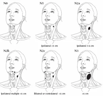 Gambar 2.14. Klasifikasi kelenjar getah bening regional (N) untuk seluruh keganasan  kepala dan leher kecuali karsinoma nasofaring dan tiroid (Greene, 2006)