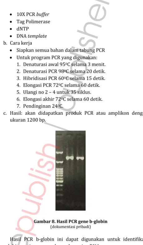 Gambar 8. Hasil PCR gene b-globin   (dokumentasi pribadi) 