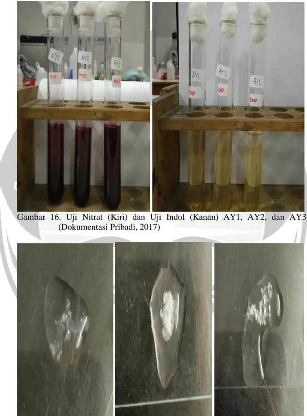 Gambar  16.  Uji  Nitrat  (Kiri)  dan  Uji  Indol  (Kanan)  AY1,  AY2,  dan  AY3  (Dokumentasi Pribadi, 2017) 