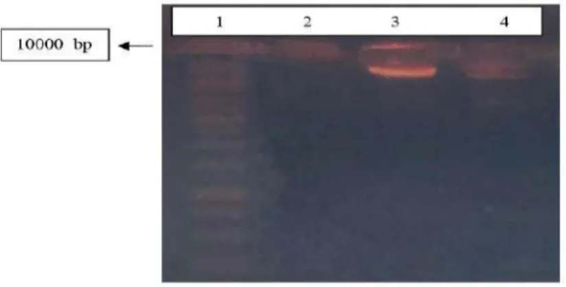 Gambar Hasil visualisasi proses elektroforesis DNA genom bakteri uji. Lajur 1 : Marker  (1kb)