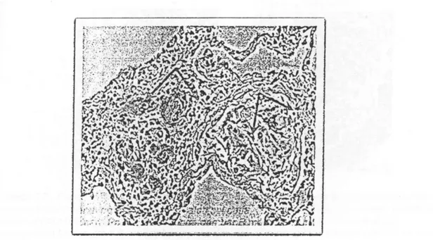 Gambar 3.5. Sel datia dengan pewamaan HE tampak sebagai sel raksasa berinti banyak, 