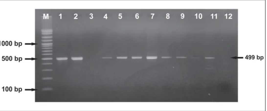 Gambar 1.   Gel elektroforesis hasil PCR 23S rRNA dari susu segar dengan primer Cremonesi et al