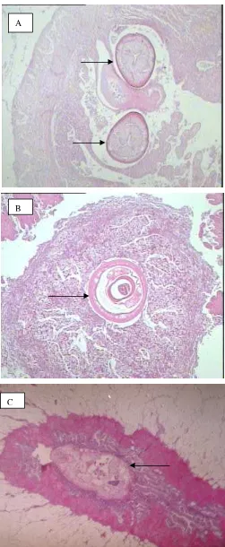 Gambar 11  Keberadaan parasit pada sediaan histopatologi pada ikan Tuna (A dan B) serta ikan ekor kuning (C)