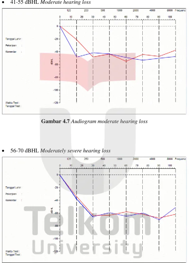 Gambar 4.8 Audiogram moderate severe hearing loss 