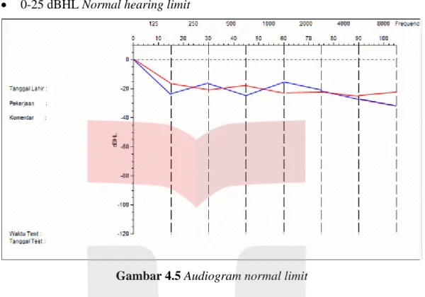Gambar 4.5 Audiogram normal limit 