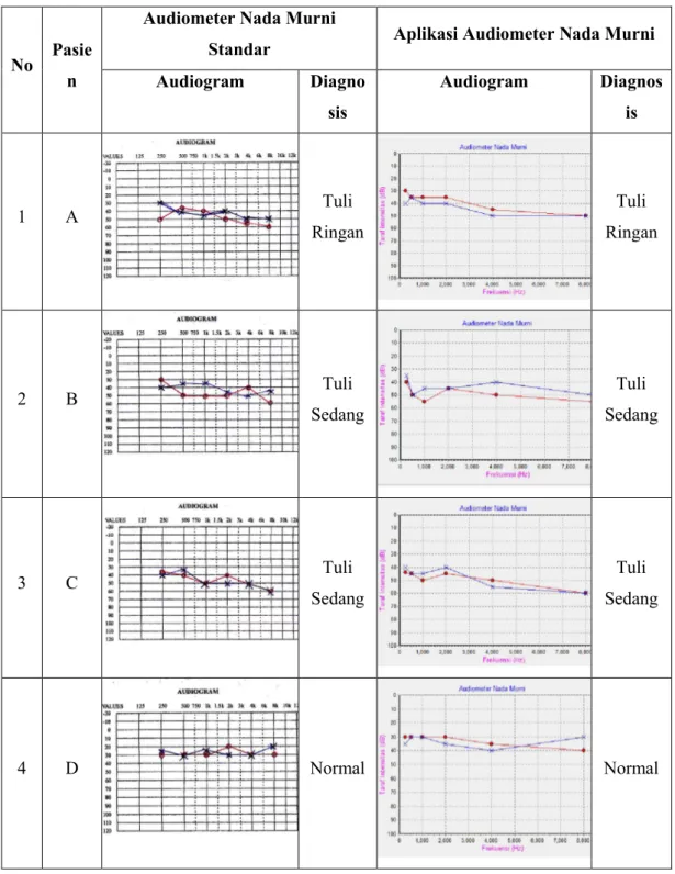 Tabel 4. Perbandingan hasil diagnosis antara audiometer nada murni standar dan aplikasi  audiometer nada murni 