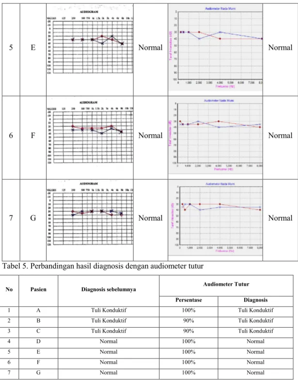 Tabel 5. Perbandingan hasil diagnosis dengan audiometer tutur 