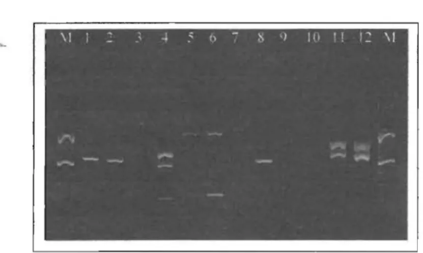 Gambar 5.  Hasil amplifikasi DNA rumput la ut K.  alvarezii,deng an  men ggunakan  primer  Ca-1 (1-2);  Ca-2  (3-4);  P-40  (5-6);  P-50  (7-8);  DALRP  (9-10); 