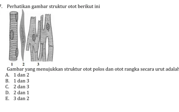 Gambar yang menujukkan struktur otot polos dan otot rangka secara urut adalah ... 