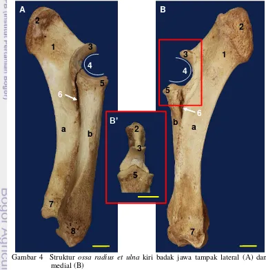Gambar 4  Struktur  ossa radius et ulna kiri badak jawa tampak lateral (A) dan     