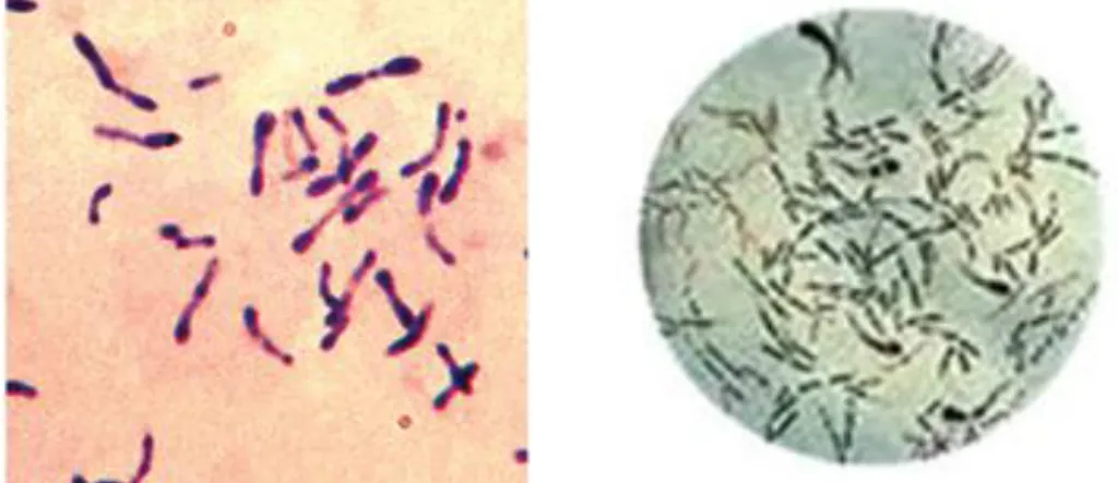Gambar I. Corynebacterium diphtheria 