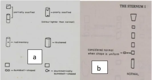 Gambar 8. a) Kelainan penulangan pada sternum dan b) Penulangan  normal pada sternum 