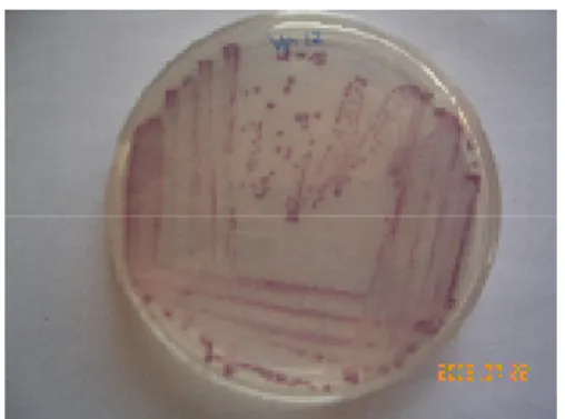Gambar  1:  Isolat  Vibrio  parahaemolyticus  hasil  isolasi  pada  media  CHROMAgar  Vibrio 
