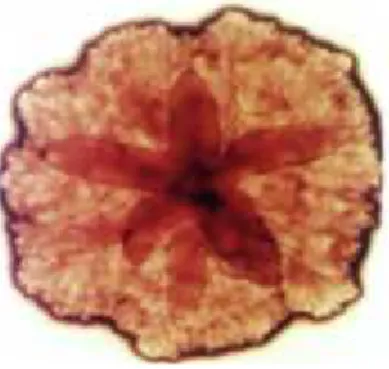 Gambar 3. A.actinomycetemcomitans