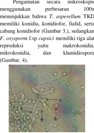 Gambar 2. Morfologi Fusarium  oxysporum f.sp. capsici dalam media PDA 