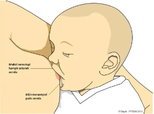 Gambar 2. Perlekatan bayi pada payudara yang benar