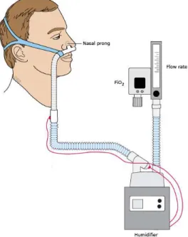 Gambar 3. Kanula hidung pada KHAT 
