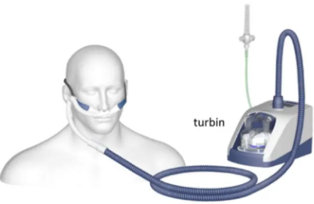 Gambar 2. KHAT dengan turbin 