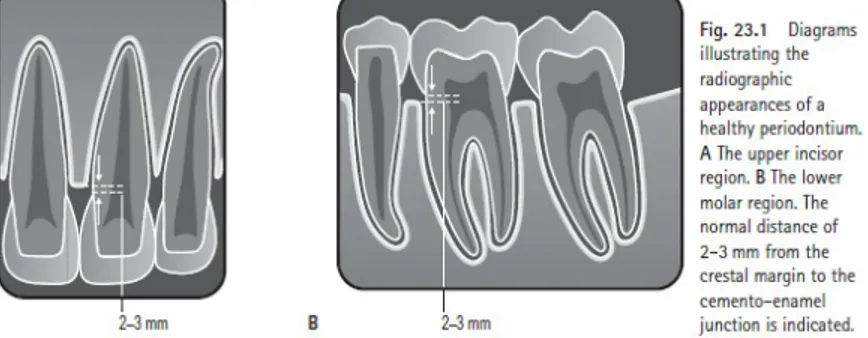 Gambar ilustrasi radiografi periodontal yang sehat