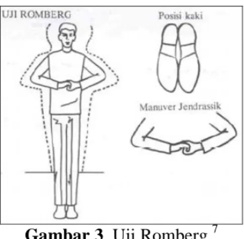 Gambar 3. Uji Romberg. 7