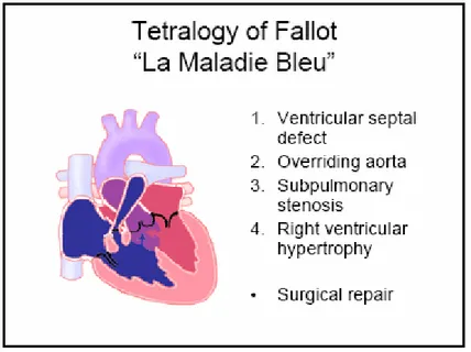Gambar Tetralogy Of Fallot (Dimodifikasi dari: www.bristol-inquiry.org.uk) Manifestasi klinik