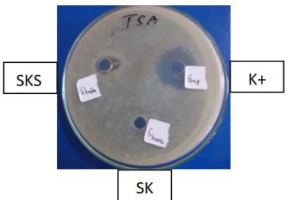 Gambar  3.  hasil  uji  antibakteri  SKS  terhadap  bakteri uji dengan metode difusi padat 