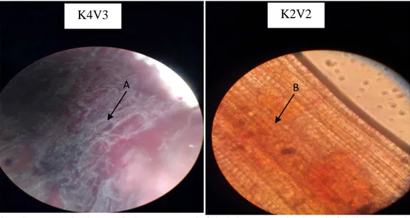 Gambar 1. Perbedaan sel akar yang terinfeksi dan yang tidak terinfeksi nematoda  Keterangan : K4V3   : Sel akar yang terinfeksi nematoda 