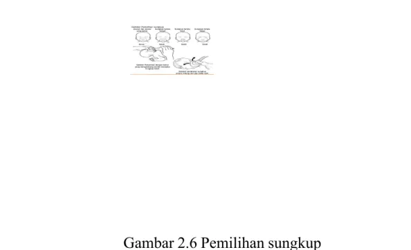 Gambar 2.6 Pemilihan sungkup 2.5.5 Kompresi Dada + VTP 7