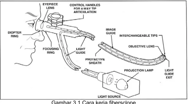 Gambar 3.1 Cara kerja fibersclope