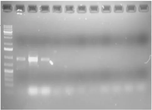 Gambar 2.6.  Hasil amplifikasi 16S rRNA bakteri BrB pada pita BrB 