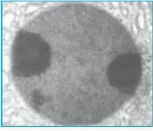 Gambar 2. Lisosom tampak pada sel 