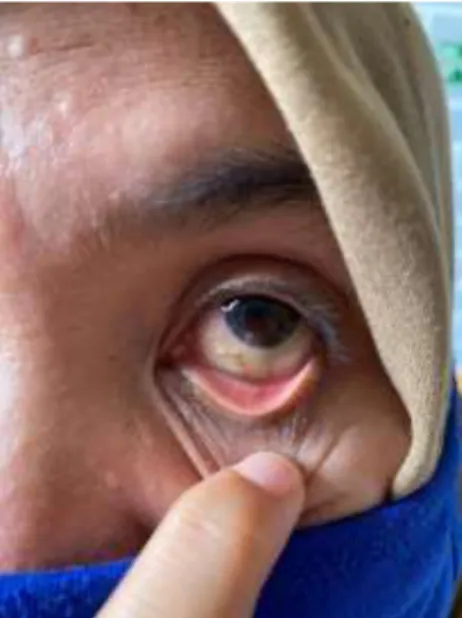 Foto terlampir . 