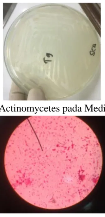 Tabel  1  menunjukkan  hasil  identifikasi  isolat  Actinomycetes.Identifikasi  makroskopik  dilakukan  dengan  pengamatan  koloni  bakteri  yang  tumbuh  pada  media  selektif  untuk  isolasi  Actinomycetes  yaitu  media  Starch  Casein  Agar  (SCA).Ident
