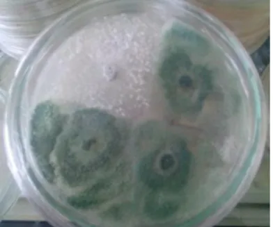 Gambar  2.  Hasil  pengamtan    uji  kesesuaian    antar    isolat  Trichoderma  ;  1)