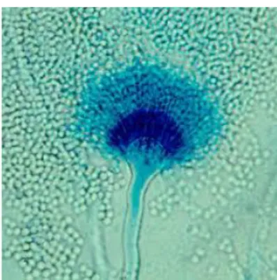 Gambar 5. Makroskopis dan Mikroskopis Aspergillus terreus  (Syaifuddin, 2017).   