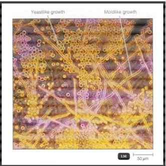 Gambar 4. Dimorfisme pada fungi (Mucor indicus) (sumber: Tortora, 2007) 