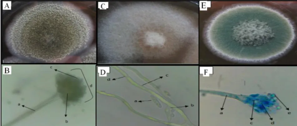 Gambar  2.  Pengamatan  koloni  kapang  (A).  makroskopik  kapang  Aspergillus,    (B)  mikroskopik  kapang  Aspergillus  perbesaran  1000x  (a=  konidiofor,  b=  vesikel,  c=  konidia,  d=  kepala  konidia),  (C)  makroskopik  kapang  Fusarium  sp.,  (D) 