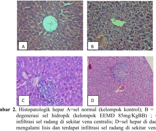Gambar 2. Histopatologik hepar A=sel normal (kelompok kontrol); B = mengalami degenerasi sel hidropik (kelompok EEMD 85mg/KgBB) ; C=terdapat infiltrasi sel radang di sekitar vena centralis; D=sel hepar di daerah perifer mengalami lisis dan terdapat infiltr