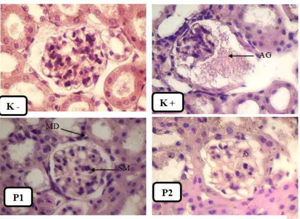 Gambar 2. Foto mikroskopis ginjal kelompok kontrol negatif (K - ), kelompok kontrol   positif (K + )  , kelompok madu (P 1 )  dan kelompok N-Acetylsysteine (P 2 ) 